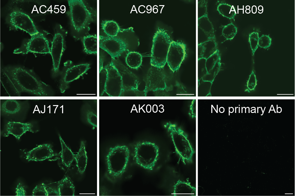 ABCD_AC459, ABCD_AJ171, ABCD_AK003 and ABCD_AH809 antibodies recognize ... ABCD_AC459, ABCD_AJ171, ABCD_AK003 and ABCD_AH809 antibodies recognize ...